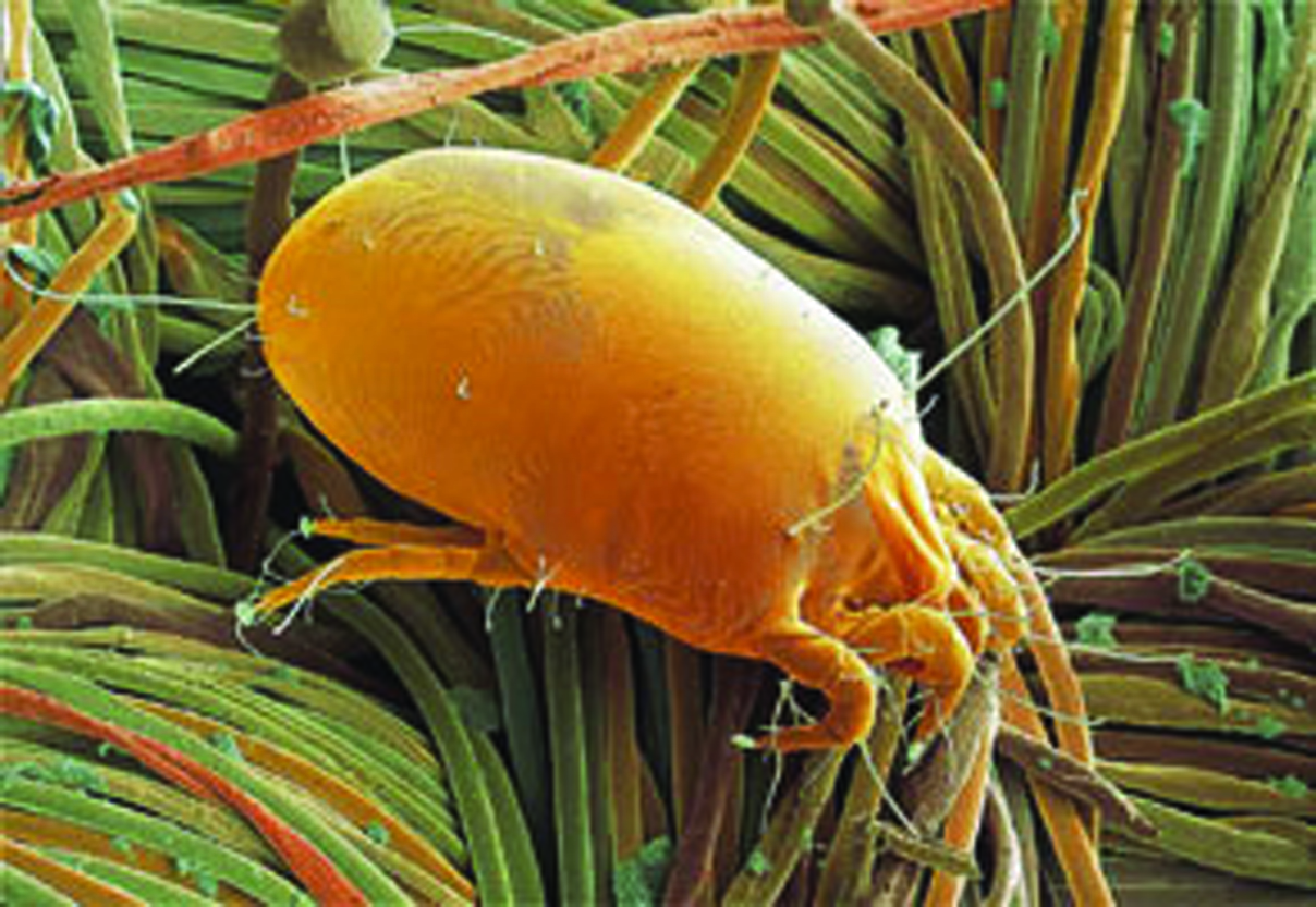 image of a dust mite